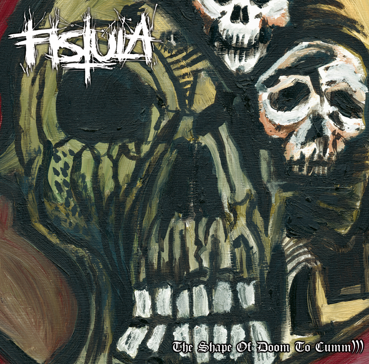 fistula